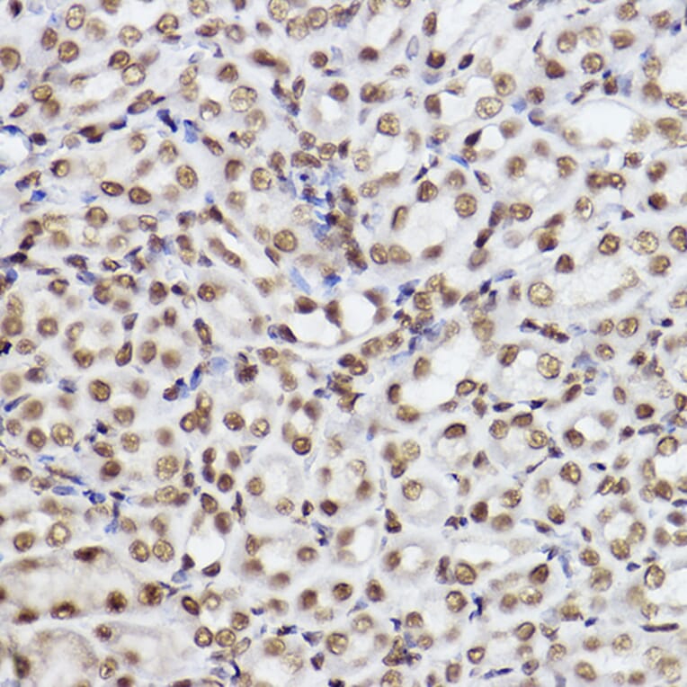Immunohistochemistry - Anti-Ube2B Antibody [ARC2512] (A305883) - Antibodies.com