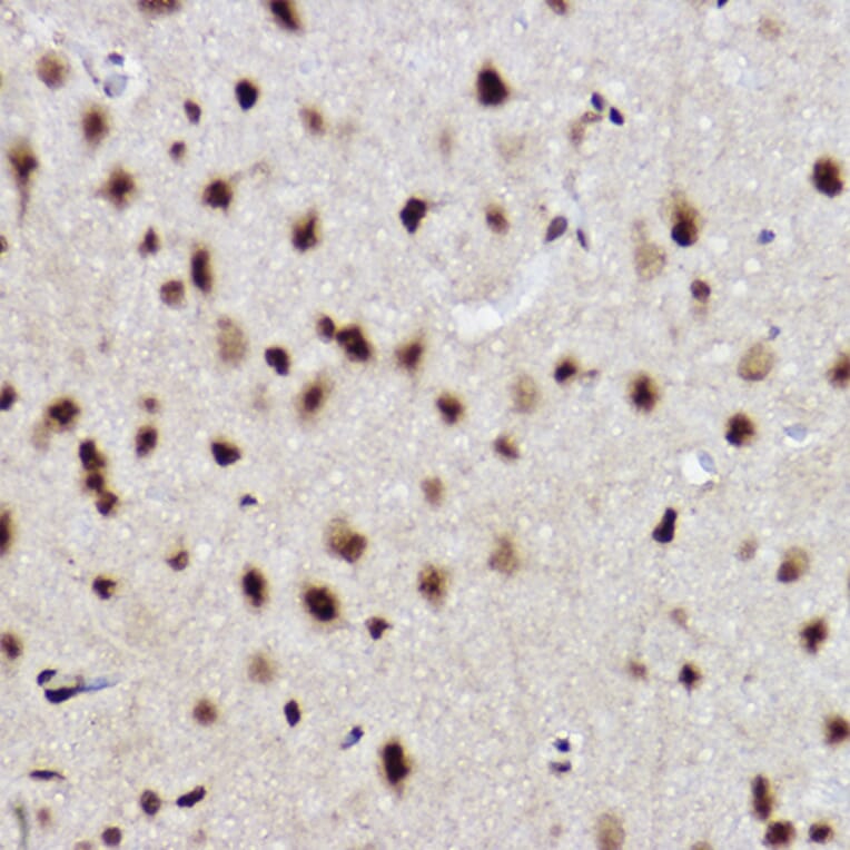 Immunohistochemistry - Anti-Ube2B Antibody [ARC2512] (A305883) - Antibodies.com
