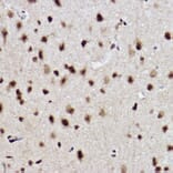 Immunohistochemistry - Anti-Ube2B Antibody [ARC2512] (A305883) - Antibodies.com