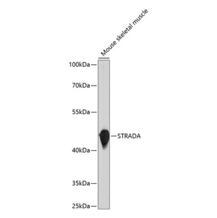 Western Blot - Anti-STRAD Antibody (A305889) - Antibodies.com