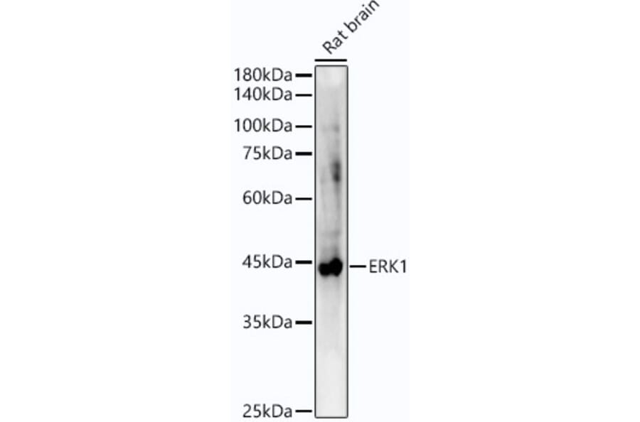 Western Blot - Anti-ERK1 Antibody [ARC51164] (A305892) - Antibodies.com