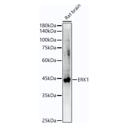 Western Blot - Anti-ERK1 Antibody [ARC51164] (A305892) - Antibodies.com