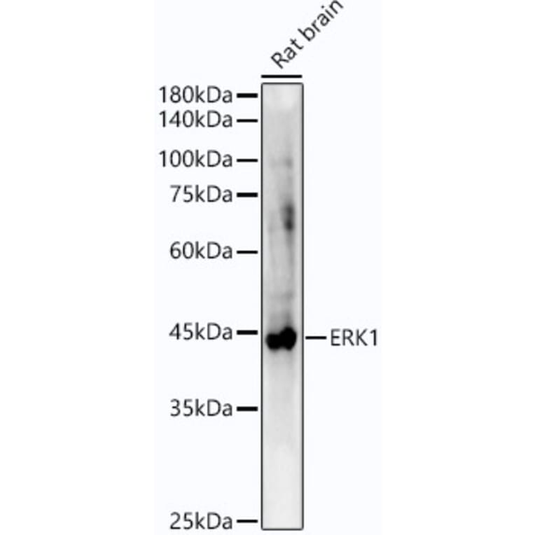 Western Blot - Anti-ERK1 Antibody [ARC51164] (A305892) - Antibodies.com