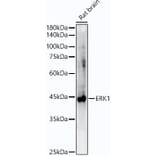 Western Blot - Anti-ERK1 Antibody [ARC51164] (A305892) - Antibodies.com