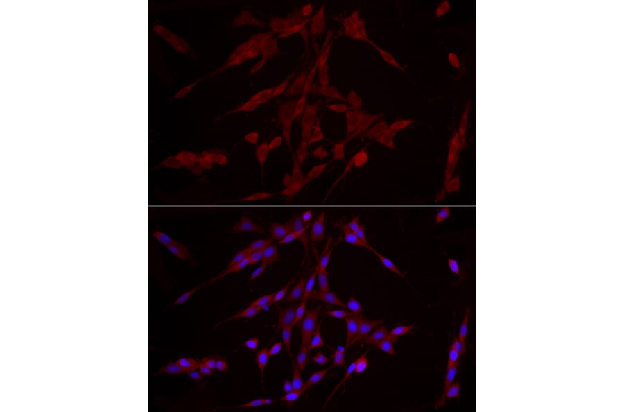Immunofluorescence - Anti-ERK1 Antibody [ARC51164] (A305892) - Antibodies.com