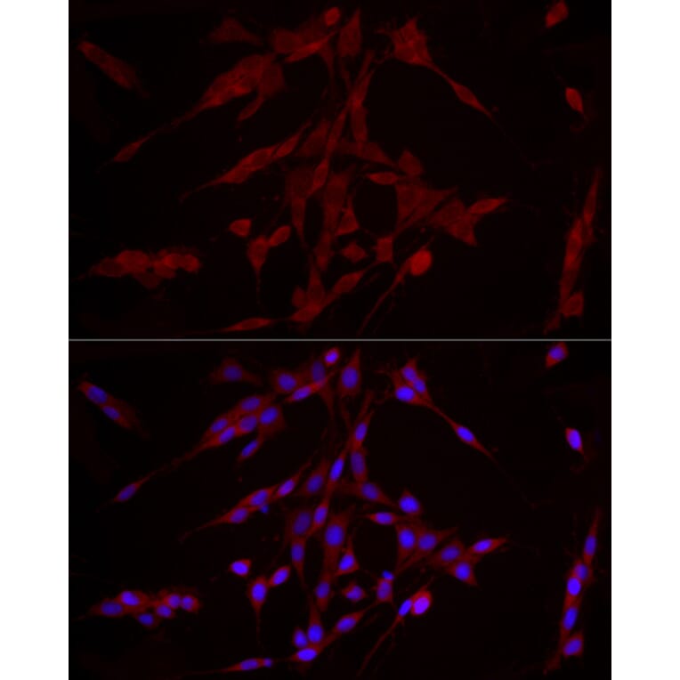 Immunofluorescence - Anti-ERK1 Antibody [ARC51164] (A305892) - Antibodies.com