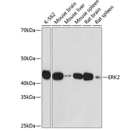 Western Blot - Anti-ERK2 Antibody [ARC51159] (A305893) - Antibodies.com