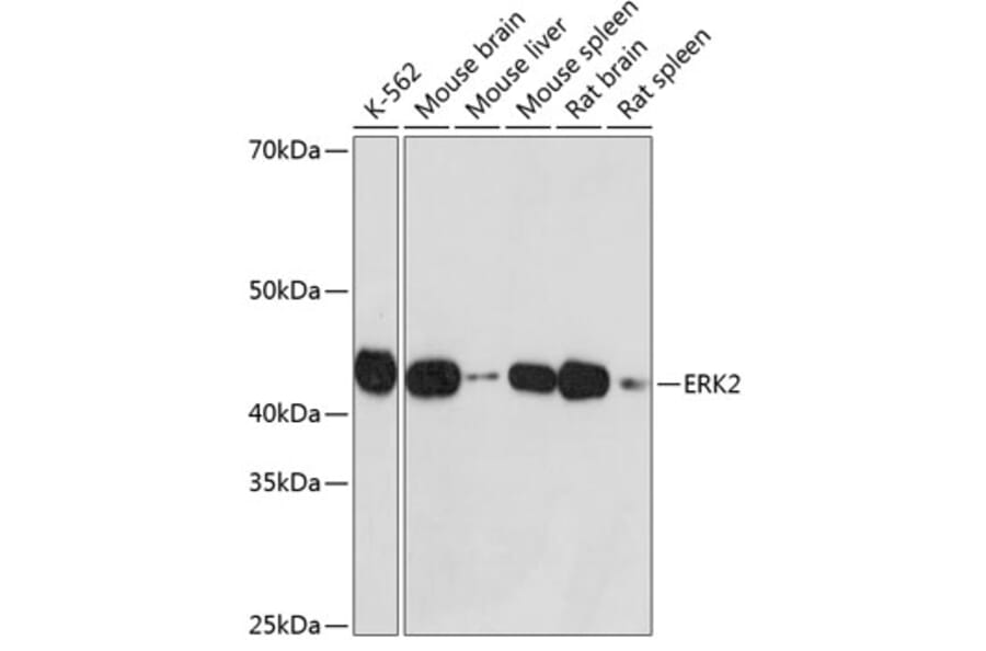 Western Blot - Anti-ERK2 Antibody [ARC51159] (A305893) - Antibodies.com