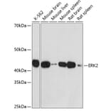 Western Blot - Anti-ERK2 Antibody [ARC51159] (A305893) - Antibodies.com