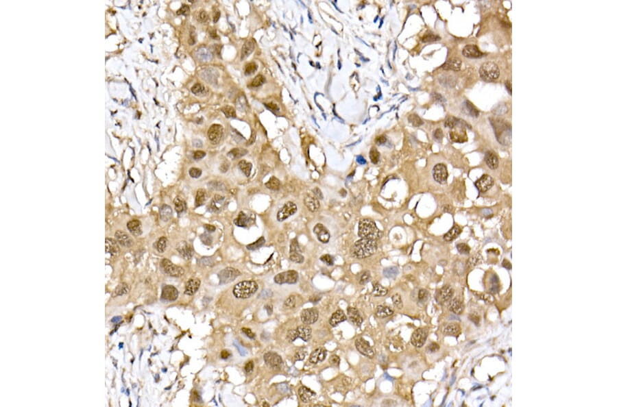 Immunohistochemistry - Anti-ERK2 Antibody [ARC51159] (A305893) - Antibodies.com