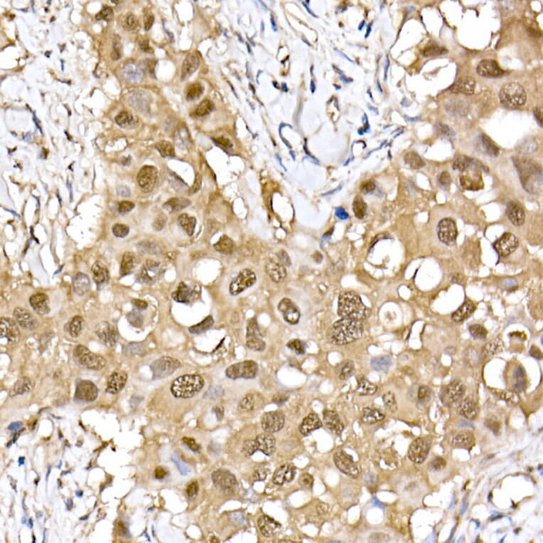 Immunohistochemistry - Anti-ERK2 Antibody [ARC51159] (A305893) - Antibodies.com