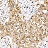 Immunohistochemistry - Anti-ERK2 Antibody [ARC51159] (A305893) - Antibodies.com