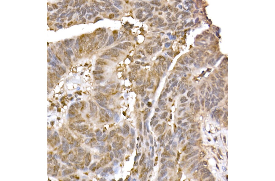 Immunohistochemistry - Anti-ERK2 Antibody [ARC51159] (A305893) - Antibodies.com