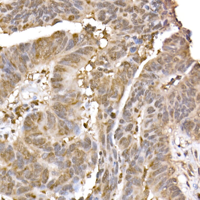 Immunohistochemistry - Anti-ERK2 Antibody [ARC51159] (A305893) - Antibodies.com