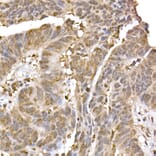 Immunohistochemistry - Anti-ERK2 Antibody [ARC51159] (A305893) - Antibodies.com