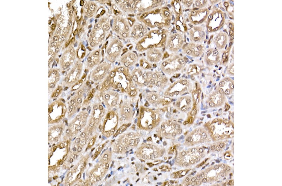 Immunohistochemistry - Anti-ERK2 Antibody [ARC51159] (A305893) - Antibodies.com