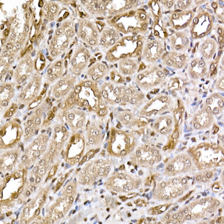 Immunohistochemistry - Anti-ERK2 Antibody [ARC51159] (A305893) - Antibodies.com