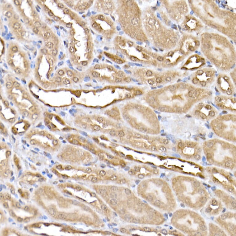 Immunohistochemistry - Anti-ERK2 Antibody [ARC51159] (A305893) - Antibodies.com