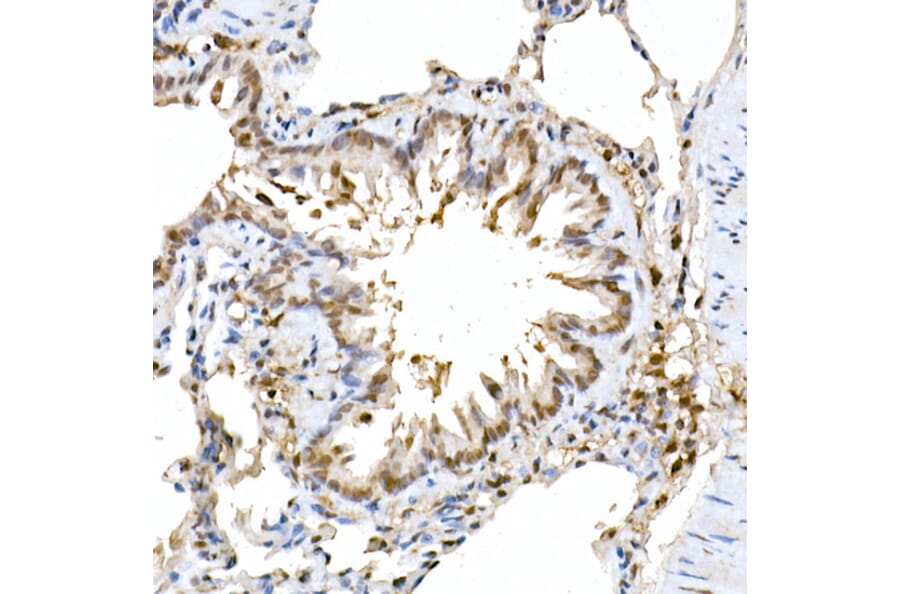 Immunohistochemistry - Anti-ERK2 Antibody [ARC51159] (A305893) - Antibodies.com