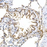 Immunohistochemistry - Anti-ERK2 Antibody [ARC51159] (A305893) - Antibodies.com