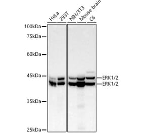 Western Blot - Anti-ERK1 + ERK2 Antibody [ARC51163] (A305894) - Antibodies.com