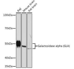 Western Blot - Anti-Galactosidase alpha Antibody [ARC1213] (A305895) - Antibodies.com