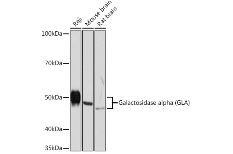 Western Blot - Anti-Galactosidase alpha Antibody [ARC1213] (A305895) - Antibodies.com