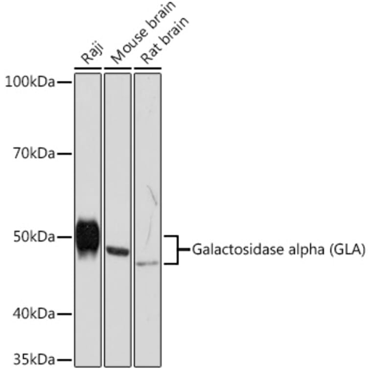 Western Blot - Anti-Galactosidase alpha Antibody [ARC1213] (A305895) - Antibodies.com