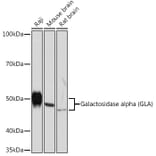Western Blot - Anti-Galactosidase alpha Antibody [ARC1213] (A305895) - Antibodies.com