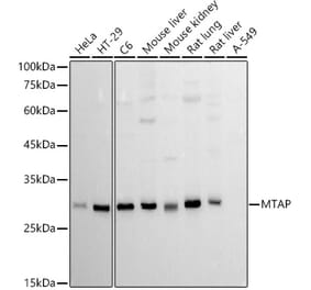 Western Blot - Anti-MTAP Antibody [ARC2872] (A305896) - Antibodies.com