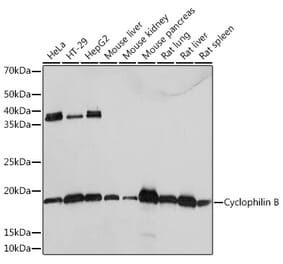 Western Blot - Anti-Cyclophilin B Antibody [ARC0290] (A305897) - Antibodies.com
