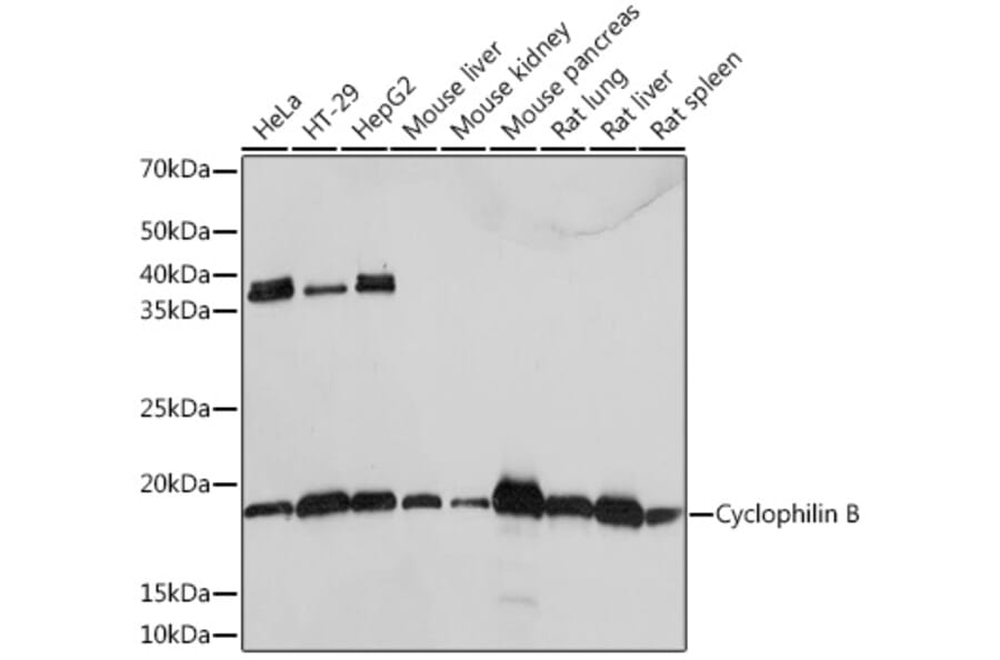 Western Blot - Anti-Cyclophilin B Antibody [ARC0290] (A305897) - Antibodies.com