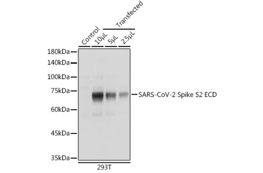 Western Blot - Anti-SARS-CoV-2 Spike Glycoprotein S2 ECD Antibody (A305898) - Antibodies.com