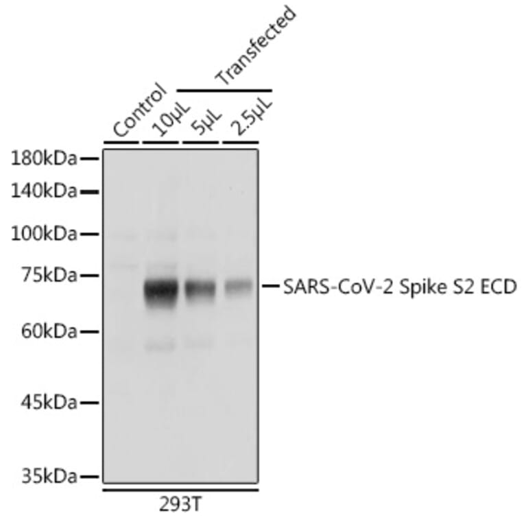 Western Blot - Anti-SARS-CoV-2 Spike Glycoprotein S2 ECD Antibody (A305898) - Antibodies.com