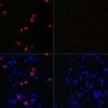 Immunofluorescence - Anti-SARS-CoV-2 Spike Glycoprotein S2 ECD Antibody (A305898) - Antibodies.com
