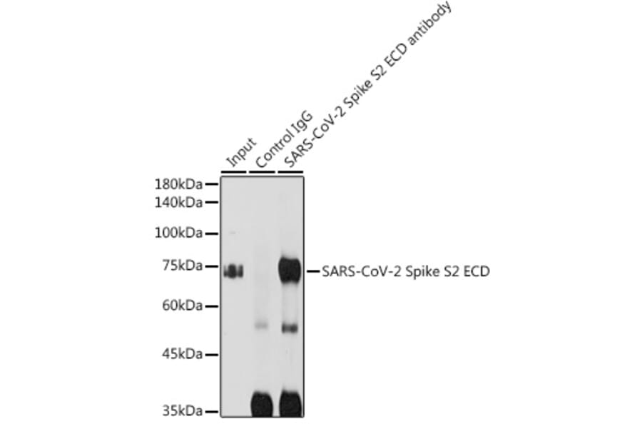 Western Blot - Anti-SARS-CoV-2 Spike Glycoprotein S2 ECD Antibody (A305898) - Antibodies.com