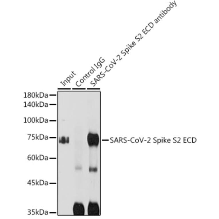 Western Blot - Anti-SARS-CoV-2 Spike Glycoprotein S2 ECD Antibody (A305898) - Antibodies.com