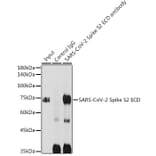 Western Blot - Anti-SARS-CoV-2 Spike Glycoprotein S2 ECD Antibody (A305898) - Antibodies.com