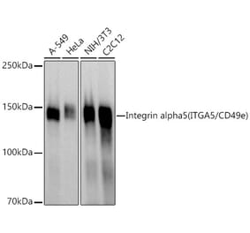 Western Blot - Anti-Integrin alpha 5 Antibody (A305899) - Antibodies.com