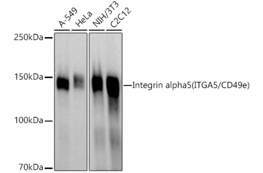 Western Blot - Anti-Integrin alpha 5 Antibody (A305899) - Antibodies.com