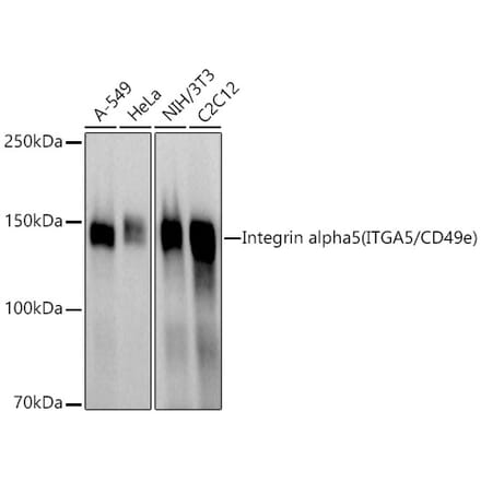 Western Blot - Anti-Integrin alpha 5 Antibody (A305899) - Antibodies.com