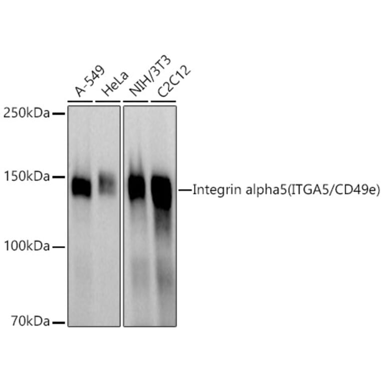 Western Blot - Anti-Integrin alpha 5 Antibody (A305899) - Antibodies.com
