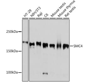 Western Blot - Anti-SMC4 Antibody [ARC2042] (A305900) - Antibodies.com