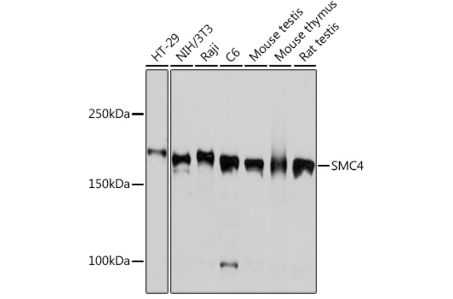 Western Blot - Anti-SMC4 Antibody [ARC2042] (A305900) - Antibodies.com