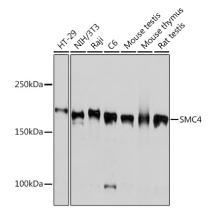 Western Blot - Anti-SMC4 Antibody [ARC2042] (A305900) - Antibodies.com