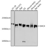 Western Blot - Anti-SMC4 Antibody [ARC2042] (A305900) - Antibodies.com
