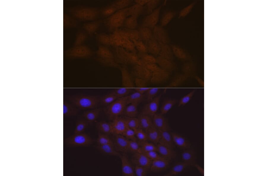 Immunofluorescence - Anti-SMC4 Antibody [ARC2042] (A305900) - Antibodies.com