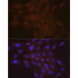 Immunofluorescence - Anti-SMC4 Antibody [ARC2042] (A305900) - Antibodies.com