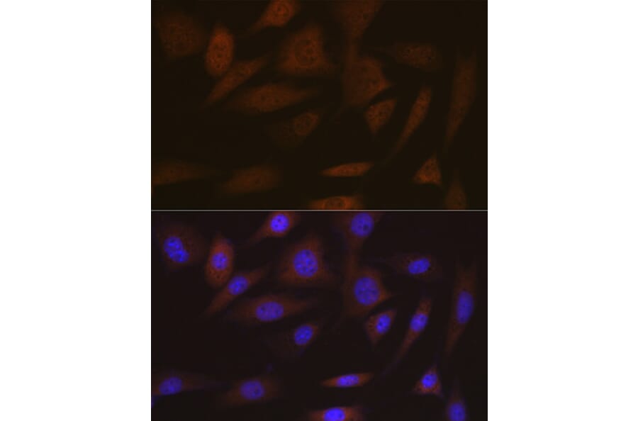 Immunofluorescence - Anti-SMC4 Antibody [ARC2042] (A305900) - Antibodies.com
