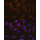 Immunofluorescence - Anti-SMC4 Antibody [ARC2042] (A305900) - Antibodies.com